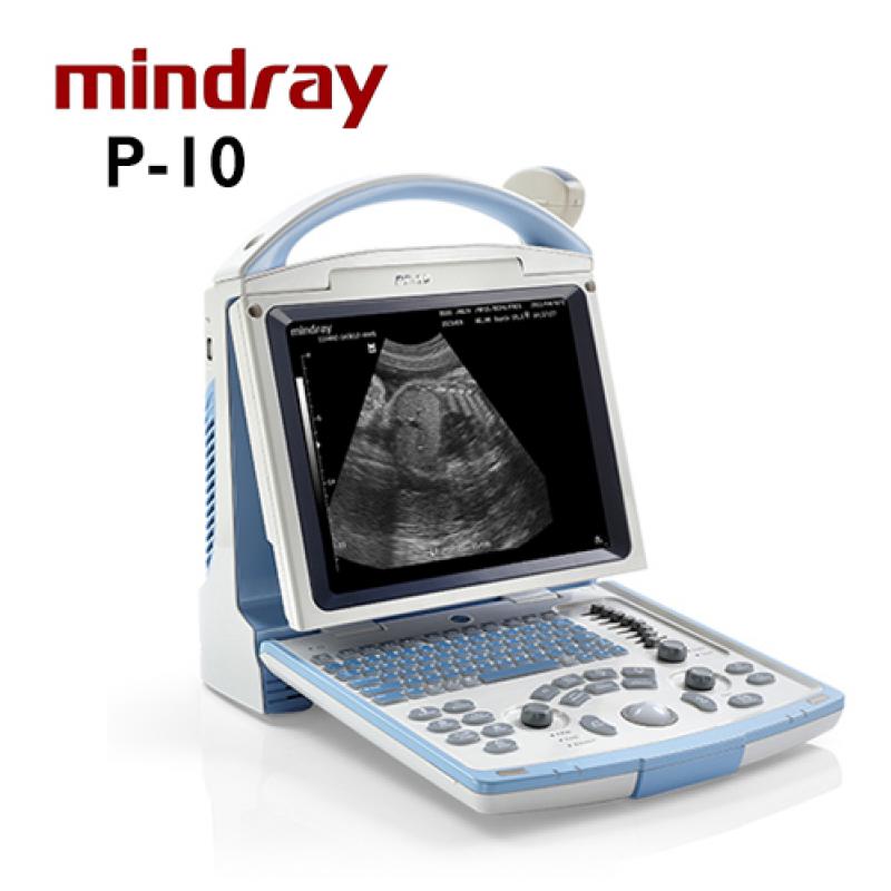 ULTRASONIDO MARCA MINDRAY MOD. DP-10