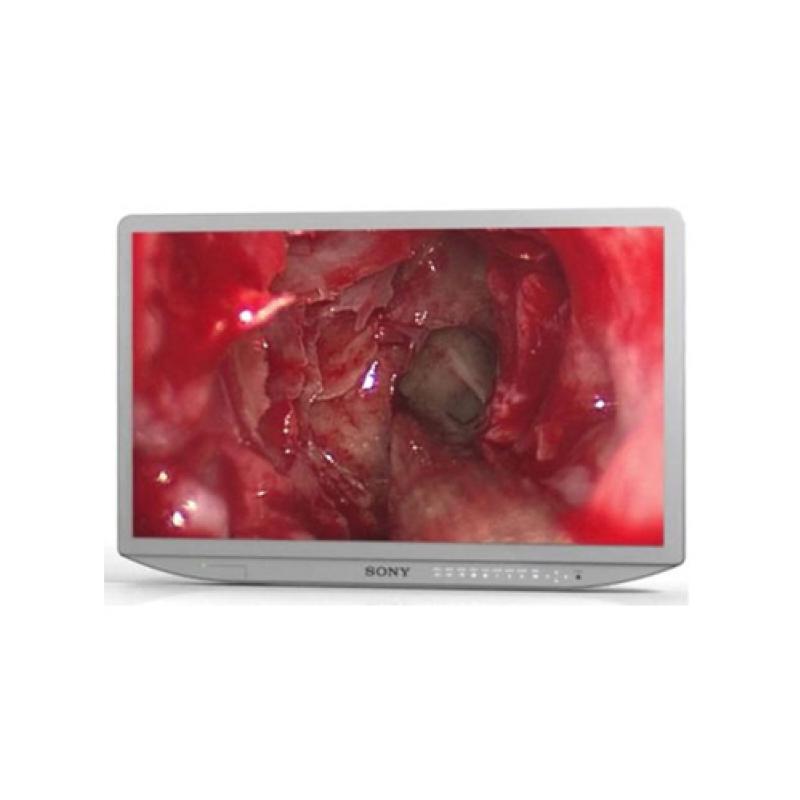 MONITOR LCD FULL HD DE 27 PULG (69CM) SONY PRODUCTO APTO PARA: MICROSCOPÍA, ENDOSCOPÍA, NEUROLOGÍA Y OFTALMOLOGÍA