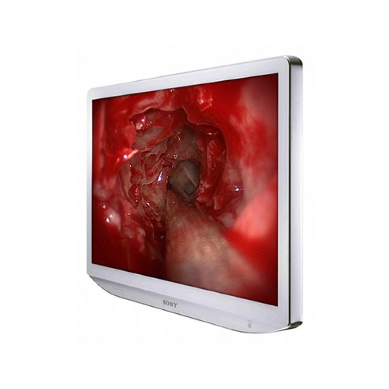 MONITOR LCD FULL HD DE 27 PULG (69CM) LMD-2765MD SONY PRODUCTO APTO PARA: MICROSCOPÍA, ENDOSCOPÍA, NEUROLOGÍA Y OFTALMOLOGÍA